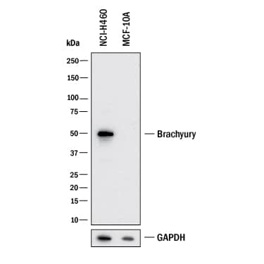 Western blot shows lysates of NCI‑H460 human large cell lung carcinoma cell line and MCF 10A human breast epithelial cell line (negative control). PVDF membrane was probed with 1 µg/mL of Goat Anti-Human/Mouse Brachyury Antigen Affinity-purified Polyclonal Antibody (Catalog # AF2085) followed by HRP-conjugated Anti-Goat IgG Secondary Antibody (HAF017). A specific band was detected for Brachyury at approximately 50 kDa (as indicated). GAPDH (AF5718) is shown as a loading control. This experiment was conducted under reducing conditions and using Western Blot Buffer Group 1.