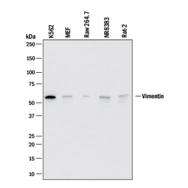 Western blot shows lysates of K562 human chronic myelogenous leukemia cell line, MEF mouse embryonic feeder cells, RAW 264.7 mouse monocyte/macrophage cell line, NR8383 rat alveolar macrophage cell line, and Rat‑2 rat embryonic fibroblast cell line. PVDF membrane was probed with 2 µg/mL of Goat Anti-Human/Mouse/Rat Vimentin Antigen Affinity-purified Polyclonal Antibody (Catalog # AF2105) followed by HRP-conjugated Anti-Goat IgG Secondary Antibody (HAF017). A specific band was detected for Vimentin at approximately 55 kDa (as indicated). This experiment was conducted under reducing conditions and using Western Blot Buffer Group 1.