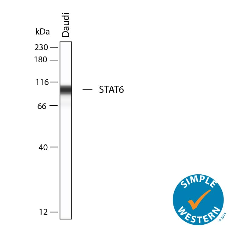 Simple Western shows lysates of Daudi human Burkitt's lymphoma cell line, loaded at 0.5 mg/ml. A specific band was detected for STAT6 at approximately 99 kDa (as indicated) using 1 µg/mL of Rabbit Anti-Human/Mouse STAT6 aa 342-640 Antigen Affinity-purified Polyclonal Antibody (Catalog # AF21671). This experiment was conducted under reducing conditions and using the 12-230 kDa separation system.