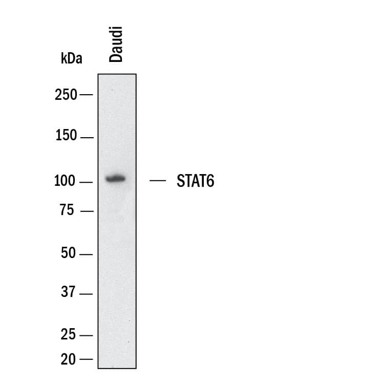 Western Blot shows lysates of Daudi human Burkitt's lymphoma cell line. PVDF membrane was probed with 1 µg/ml of Goat Anti-Human/Mouse/Rat STAT6 aa 627-838 Antigen Affinity-purified Polyclonal Antibody (Catalog # AF2167) followed by HRP-conjugated Anti-Goat IgG Secondary Antibody (Catalog # HAF017). A specific band was detected for STAT6 at approximately 100 kDa (as indicated).  This experiment was conducted under reducing conditions and using Western Blot Buffer Group 1.