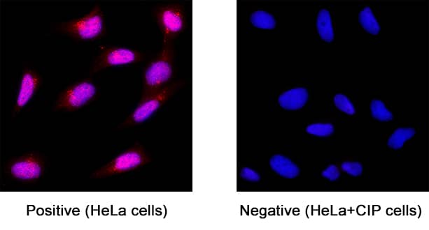 ATM was detected in immersion fixed HeLa human cervical epithelial carcinoma cell line (untreated; positive staining) and HeLa human cervical epithelial carcinoma cell line treated with CIP (negative staining) using Sheep Anti-Human ATM Antigen Affinity-purified Polyclonal Antibody (Catalog # AF2290) at 3 &micro;g/mL for 3 hours at room temperature. Cells were stained using the NorthernLights&trade; 557-conjugated Anti-Rabbit IgG Secondary Antibody (red; NL004) and counterstained with DAPI (blue). Specific staining was localized to cell nuclei. Staining was performed using our protocol for Fluorescent ICC Staining of Non-adherent Cells.