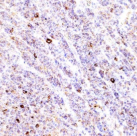 Immunohistochemistry LAG-3 Antibody [Unconjugated]