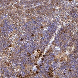 Immunohistochemistry LAG-3 Antibody [Unconjugated]