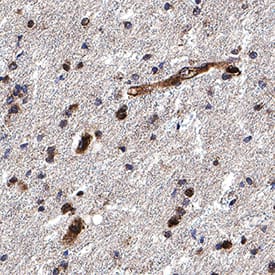 Olig2 was detected in immersion fixed paraffin-embedded sections of human brain (cortex) using Goat Anti-Human/Mouse/Rat Olig2 Antigen Affinity-purified Polyclonal Antibody (Catalog # AF2418) at 10 &micro;g/mL for 1 hour at room temperature followed by incubation with the Anti-Goat IgG VisUCyte&trade; HRP Polymer Antibody (VC004). Before incubation with the primary antibody, tissue was subjected to heat-induced epitope retrieval using Antigen Retrieval Reagent-Basic (CTS013). Tissue was stained using DAB (brown) and counterstained with hematoxylin (blue).  Specific staining was localized to cell nuclei. Staining was performed using our protocol for IHC Staining with VisUCyte HRP Polymer Detection Reagents.