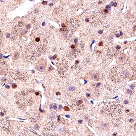 Olig2 was detected in immersion fixed paraffin-embedded sections of rat midbrain using Goat Anti-Human/Mouse/Rat Olig2 Antigen Affinity-purified Polyclonal Antibody (Catalog # AF2418) at 10 &micro;g/mL for 1 hour at room temperature followed by incubation with the Anti-Goat IgG VisUCyte&trade; HRP Polymer Antibody (VC004). Before incubation with the primary antibody, tissue was subjected to heat-induced epitope retrieval using Antigen Retrieval Reagent-Basic (CTS013). Tissue was stained using DAB (brown) and counterstained with hematoxylin (blue).  Specific staining was localized to cell nuclei. Staining was performed using our protocol for IHC Staining with VisUCyte HRP Polymer Detection Reagents.