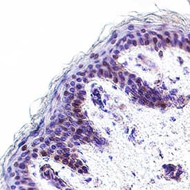 Pax3 was detected in immersion fixed paraffin-embedded sections of human skin using Goat Anti-Human Pax3 Antigen Affinity-purified Polyclonal Antibody (Catalog # AF2457) at 3 µg/ml for 1 hour at room temperature followed by incubation with the Anti-Goat IgG VisUCyte™ HRP Polymer Antibody (Catalog # VC004) or the HRP-conjugated Anti-Goat IgG Secondary Antibody (Catalog # HAF109). Before incubation with the primary antibody, tissue was subjected to heat-induced epitope retrieval using VisUCyte Antigen Retrieval Reagent-Basic (Catalog # VCTS021). Tissue was stained using DAB (brown) and counterstained with hematoxylin (blue). Specific staining was localized to the nucleus of melanocytes. View our protocol for IHC Staining with VisUCyte HRP Polymer Detection Reagents.