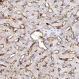 Immunohistochemistry MMR/CD206/Mannose Receptor Antibody [Unconjugated]
