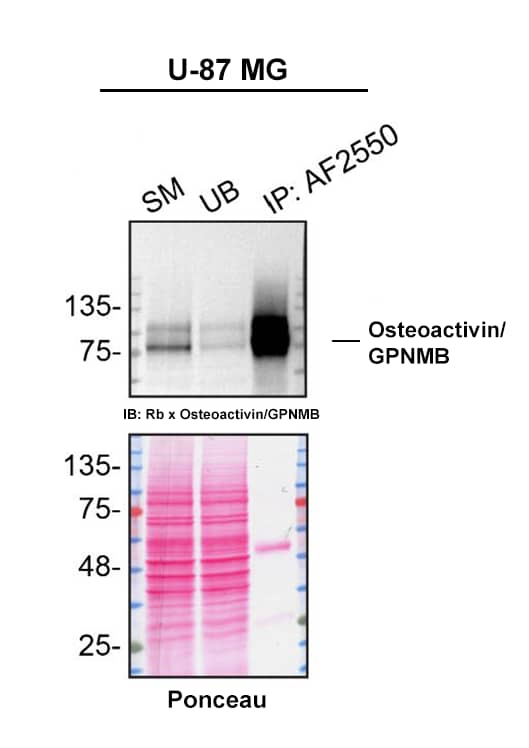 U‑87 MG human glioblastoma/astrocytoma cell line lysates were prepared and immunoprecipitation was performed using 2.0 μg of Goat Anti-Human Osteoactivin/GPNMB Antigen Affinity-purified Polyclonal Antibody (Catalog # AF2550) pre-coupled to Dynabeads Protein G. Immunoprecipitated Osteoactivin/GPNMB was detected in Western Blot with a Rabbit Osteoactivin/GPNMB Antibody. The Ponceau stained transfer of the blot is shown. SM=4% starting material; UB=4% unbound fraction; IP=immunoprecipitate; HC=antibody heavy chain. Image, protocol and testing courtesy of YCharOS Inc. (ycharos.com).