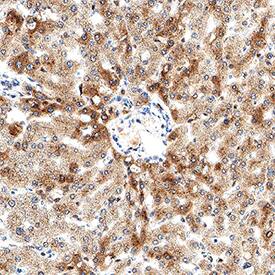Immunohistochemistry Angiogenin Antibody [Unconjugated]