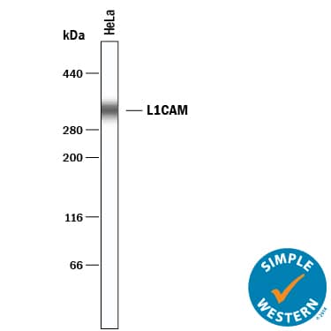 Simple Western lane view shows lysates of HeLa human cervical epithelial carcinoma cell line, loaded at 0.2 mg/mL. A specific band was detected for L1CAM at approximately 333 kDa (as indicated) using 5 µg/mL of Goat Anti-Human L1CAM Antigen Affinity-purified Polyclonal Antibody (Catalog # AF277) . This experiment was conducted under reducing conditions and using the 66-440 kDa separation system.