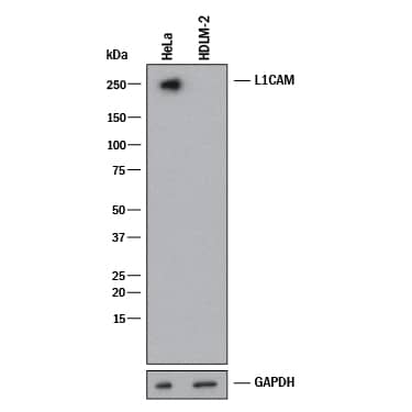 Western blot shows lysates of HeLa human cervical epithelial carcinoma cell line and HDLM‑2 human Hodgkin’s lymphoma cell line (negative control). PVDF membrane was probed with 0.25 µg/mL of Goat Anti-Human L1CAM Antigen Affinity-purified Polyclonal Antibody (Catalog # AF277) followed by HRP-conjugated Anti-Goat IgG Secondary Antibody (HAF017). A specific band was detected for L1CAM at approximately 250 kDa (as indicated). GAPDH (AF5718) is shown as a loading control. This experiment was conducted under reducing conditions and using Western Blot Buffer Group 1.
