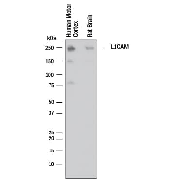 Western blot shows lysates of human brain (motor cortex) and rat brain. PVDF membrane was probed with 0.5 µg/mL of Goat Anti-Human L1CAM Antigen Affinity-purified Polyclonal Antibody (Catalog # AF277) followed by HRP-conjugated Anti-Goat IgG Secondary Antibody (HAF017). A specific band was detected for L1CAM at approximately 240 kDa (as indicated). This experiment was conducted under reducing conditions and using Western Blot Buffer Group 1.