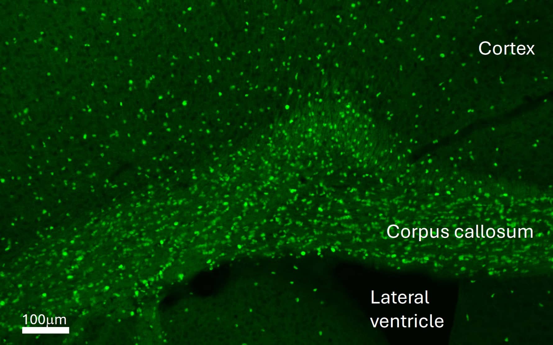 Adult mouse (P6W) brain perfused with 4% paraformaldehyde/PBS, 30 um free floating section. Block with 1% BSA/0.3% Triton X-100/PBS for 30min, primary antibody (1:1000, 0.2ug/ml), secondary antibody (anti-goat Alexa Fluor 488). Antigen retrieval treatment was not needed. Image from a verified customer review.