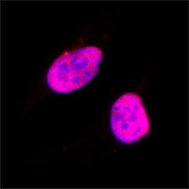 SOX10 was detected in immersion fixed SK‑Mel‑28 human malignant melanoma cell line using Goat Anti-Human SOX10 Antigen Affinity-purified Polyclonal Antibody (Catalog # AF2864) at 15 &micro;g/mL for 3 hours at room temperature. Cells were stained using the NorthernLights&trade; 557-conjugated Anti-Goat IgG Secondary Antibody (red; NL001) and counterstained with DAPI (blue). Specific staining was localized to cell nuclei. Staining was performed using our protocol for Fluorescent ICC Staining of Non-adherent Cells.