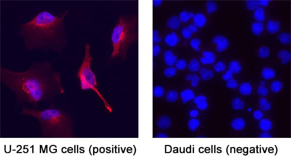 Immunocytochemistry Versican Antibody [Unconjugated] - Isoform V0