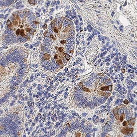 Immunohistochemistry Kallikrein 12 Antibody [Unconjugated]