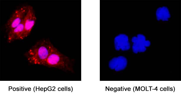Immunocytochemistry GCNF/NR6A1 Antibody [Unconjugated]