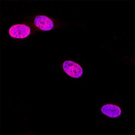 HMGA2 was detected in immersion fixed IMR‑90 human lung fibroblast cell line using Goat Anti-Human/Mouse HMGA2 Antigen Affinity-purified Polyclonal Antibody (Catalog # AF3184) at 5 &micro;g/mL for 3 hours at room temperature. Cells were stained using the NorthernLights&trade; 557-conjugated Anti-Goat IgG Secondary Antibody (red; NL001) and counterstained with DAPI (blue). Specific staining was localized to cell nuclei. Staining was performed using our protocol for Fluorescent ICC Staining of Non-adherent Cells.