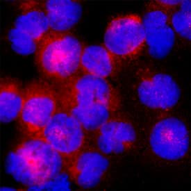 Immunocytochemistry CISH/CIS-1 Antibody [Unconjugated]