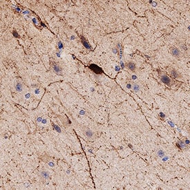 Immunohistochemistry Calbindin D/S100G Antibody [Unconjugated]