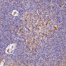Immunohistochemistry LAG-3 Antibody [Unconjugated]