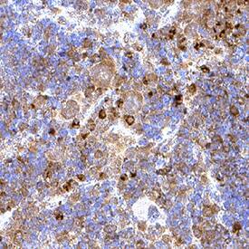 Immunohistochemistry LAG-3 Antibody [Unconjugated]