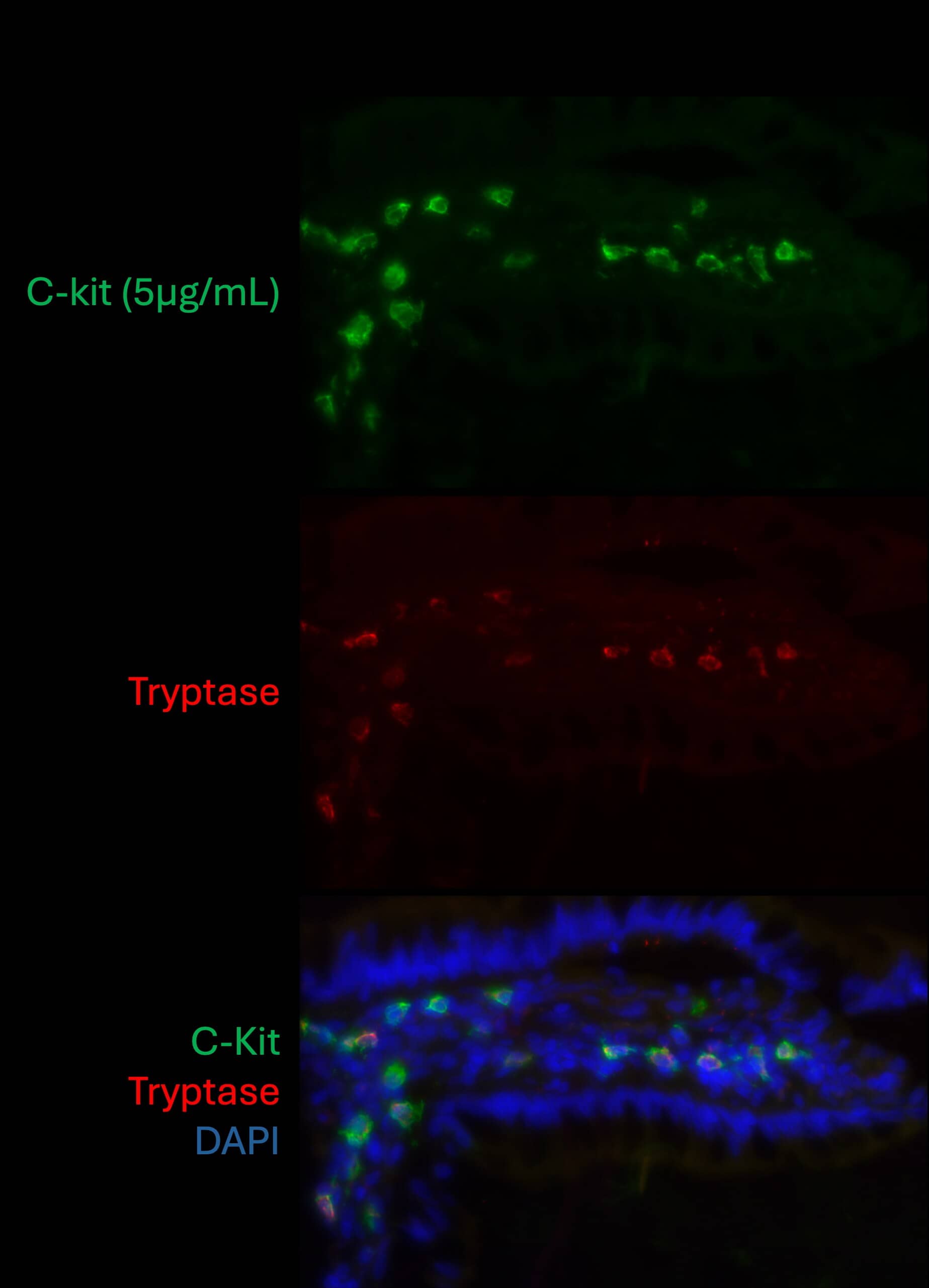 Immunohistochemistry CD117/c-kit Antibody [Unconjugated]
