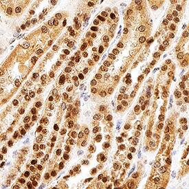 Pax2 was detected in immersion fixed paraffin-embedded sections of human kidney using Goat Anti-Human Pax2 Antigen Affinity-purified Polyclonal Antibody (Catalog # AF3364) at 1 &micro;g/mL for 1 hour at room temperature followed by incubation with the Anti-Goat IgG VisUCyte&trade; HRP Polymer Antibody (VC004). Before incubation with the primary antibody, tissue was subjected to heat-induced epitope retrieval using Antigen Retrieval Reagent-Basic (CTS013). Tissue was stained using DAB (brown) and counterstained with hematoxylin (blue).  Specific staining was localized to cell nuclei in convoluted tubules. Staining was performed using our protocol for IHC Staining with VisUCyte HRP Polymer Detection Reagents.
