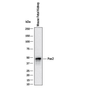 Western blot shows lysates of mouse fetal kidney. PVDF Membrane was probed with 1 µg/mL of Goat Anti-Human Pax2 Antigen Affinity-purified Polyclonal Antibody (Catalog # AF3364) followed by HRP-conjugated Anti-Goat IgG Secondary Antibody (HAF017). A specific band was detected for Pax2 at approximately 47 kDa (as indicated). This experiment was conducted under reducing conditions and using Western Blot Buffer Group 1.