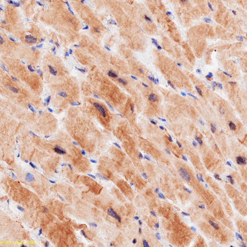 Atrial Natriuretic Peptide/ANP was detected in immersion fixed paraffin-embedded sections of human heart using Goat Anti-Human Atrial Natriuretic Peptide/ANP Antigen Affinity-purified Polyclonal Antibody (Catalog # AF3366) at 1 µg/ml overnight at 4 &deg;C. Before incubation with the primary antibody, tissue was subjected to heat-induced epitope retrieval using VisUCyte Antigen Retrieval Reagent-Basic (Catalog # VCTS021). Tissue was stained using the HRP-conjugated Anti-Goat IgG Secondary Antibody (Catalog # HAF017) and counterstained with hematoxylin (blue). Specific staining was localized to the cytoplasm. View our protocol for Chromogenic IHC Staining of Paraffin-embedded Tissue Sections.