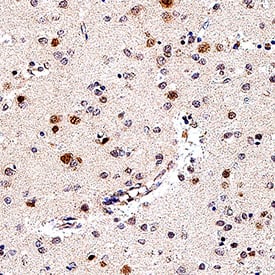 SOX1 was detected in immersion fixed paraffin-embedded sections of human brain (cortex) using Goat Anti-Human/Mouse/Rat SOX1 Antigen Affinity-purified Polyclonal Antibody (Catalog # AF3369) at 3 &micro;g/mL for 1 hour at room temperature followed by incubation with the Anti-Mouse IgG VisUCyte&trade;  HRP Polymer Antibody (VC001). Before incubation with the primary antibody, tissue was subjected to heat-induced epitope retrieval using Antigen Retrieval Reagent-Basic (CTS013). Tissue was stained using DAB (brown) and counterstained with hematoxylin (blue).  Specific staining was localized to nuclei in neuron. Staining was performed using our protocol for IHC Staining with VisUCyte HRP Polymer Detection Reagents.