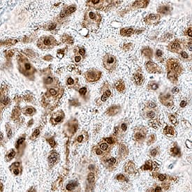 Immunohistochemistry Neurogenin-3 Antibody [Unconjugated]