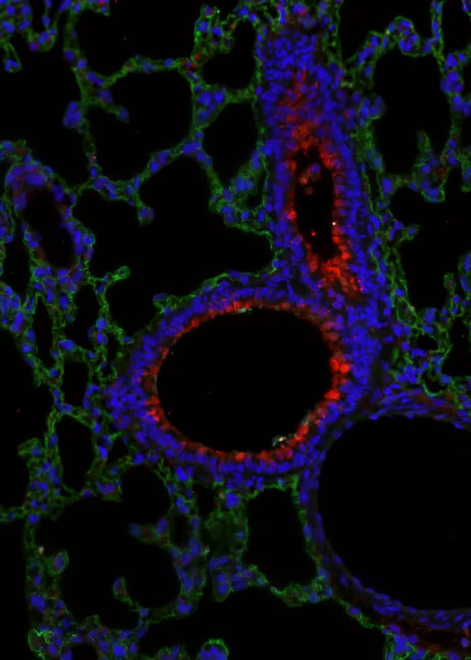 Immunohistochemistry UGRP1/SCGB3A2 Antibody [Unconjugated]