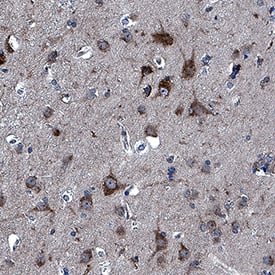 CX3CL1/Fractalkine was detected in immersion fixed paraffin-embedded sections of human brain (cortex) using Goat Anti-Human CX3CL1/Fractalkine Antigen Affinity-purified Polyclonal Antibody (Catalog # AF3651) at 5 µg/mL for 1 hour at room temperature followed by incubation with the Anti-Goat IgG VisUCyte™ HRP Polymer Antibody (VC004). Before incubation with the primary antibody, tissue was subjected to heat-induced epitope retrieval using Antigen Retrieval Reagent-Basic (CTS013)). Tissue was stained using DAB (brown) and counterstained with hematoxylin (blue). Specific staining was localized to neuronal cell bodies. Staining was performed using our protocol for IHC Staining with VisUCyte HRP Polymer Detection Reagents.