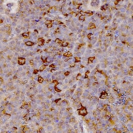Myeloperoxidase/MPO was detected in immersion fixed paraffin-embedded sections of mouse spleen tissue using Goat Anti-Human/Mouse Myeloperoxidase/MPO Antigen Affinity-purified Polyclonal Antibody (Catalog # AF3667) at 1 &micro;g/mL for 1 hour at room temperature followed by incubation with the Anti-Goat IgG VisUCyte&trade; HRP Polymer Antibody (VC004). Tissue was stained using DAB (brown) and counterstained with hematoxylin (blue). Specific staining was localized to lymphocytes. Staining was performed using our IHC Staining with VisUCyte HRP Polymer Detection Reagents.For human Immunohistochemistry samples, we recommend Mouse Anti-Human Myeloperoxidase/ MPO Monoclonal Antibody (MAB3174).