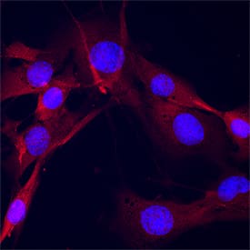Park7/DJ‑1 was detected in immersion fixed C2C12 mouse myoblast cell line using Goat Anti-Human/Mouse Park7/DJ‑1 Antigen Affinity-purified Polyclonal Antibody (Catalog # AF3668) at 15 &micro;g/mL for 3 hours at room temperature. Cells were stained using the NorthernLights&trade; 557-conjugated Anti-Goat IgG Secondary Antibody (red; NL001) and counterstained with DAPI (blue). Specific staining was localized to cytoplasm. Staining was performed using our protocol for Fluorescent ICC Staining of Non-adherent Cells.