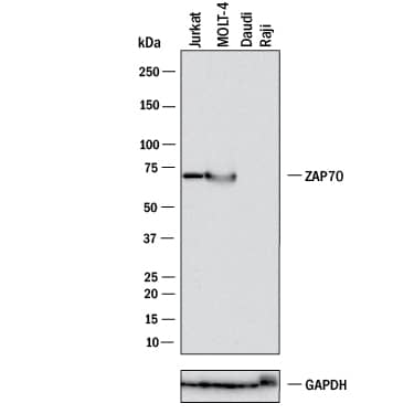 Western Blot ZAP70 Antibody [Unconjugated]