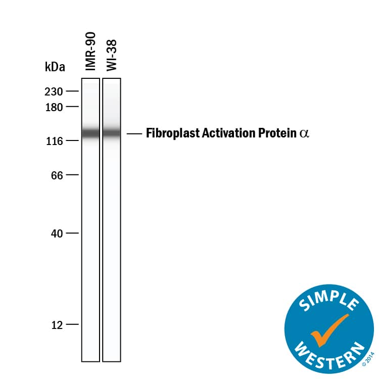 Simple Western Fibroblast Activation Protein alpha/FAP Antibody [Unconjugated]