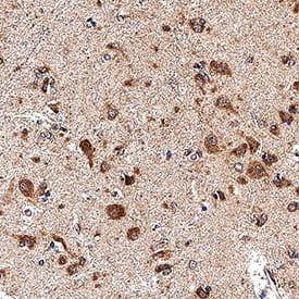 Smad2/3 was detected in immersion fixed paraffin-embedded sections of human brain (cortex) using Goat Anti-Human/Mouse Smad2/3 Antigen Affinity-purified Polyclonal Antibody (Catalog # AF3797) at 3 &micro;g/mL for 1 hour at room temperature followed by incubation with the Anti-Goat IgG VisUCyte&trade; HRP Polymer Antibody (VC004). Before incubation with the primary antibody, tissue was subjected to heat-induced epitope retrieval using Antigen Retrieval Reagent-Basic (CTS013). Tissue was stained using DAB (brown) and counterstained with hematoxylin (blue).  Specific staining was localized to cytoplasm in neurons. Staining was performed using our protocol for IHC Staining with VisUCyte HRP Polymer Detection Reagents.
