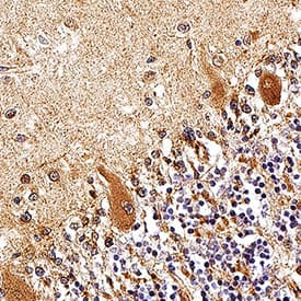 Immunohistochemistry Smad2/3 Antibody [Unconjugated]