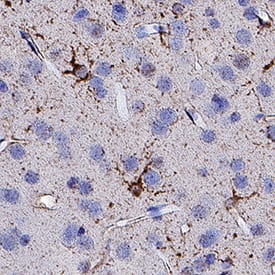 Immunohistochemistry Plexin A3 Antibody [Unconjugated]