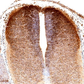 Immunohistochemistry IGFBP-L1 Antibody [Unconjugated]