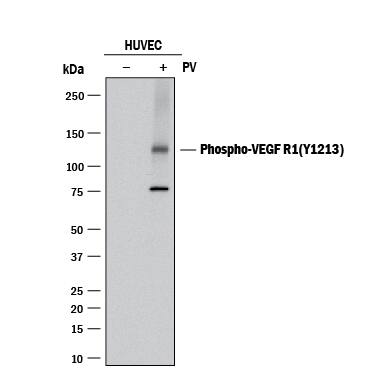 Western blot shows lysates of HUVEC human umbilical vein endothelial cell untreated (-) or treated (+) with 100 µM pervanadate (PV) for 10 minutes. PVDF membrane was probed with 0.1 µg/mL of Rabbit Anti-Human Phospho-VEGFR1/Flt-1 (Y1213) Antigen Affinity-purified Polyclonal Antibody (Catalog # AF4170), followed by HRP-conjugated Anti-Rabbit IgG Secondary Antibody (Catalog # HAF008). A specific band was detected for Phospho-VEGFR1/Flt-1 (Y1213) at approximately 130-140 kDa (as indicated). This experiment was conducted under reducing conditions and using Immunoblot Buffer Group 1.