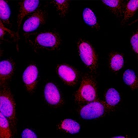 Immunocytochemistry MLX Antibody [Unconjugated]