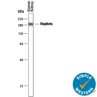 Simple Western Nephrin Antibody [Unconjugated]