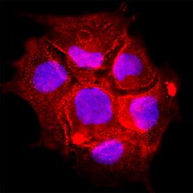 Numb was detected in immersion fixed RT‑4 human urinary bladder transitional cell papilloma cell line using Sheep Anti-Human Numb Antigen Affinity-purified Polyclonal Antibody (Catalog # AF4338) at 5 &micro;g/mL for 3 hours at room temperature. Cells were stained using the NorthernLights&trade; 557-conjugated Anti-Sheep IgG Secondary Antibody (red; NL010) and counterstained with DAPI (blue). Specific staining was localized to cytoplasm. Staining was performed using our protocol for Fluorescent ICC Staining of Non-adherent Cells.
