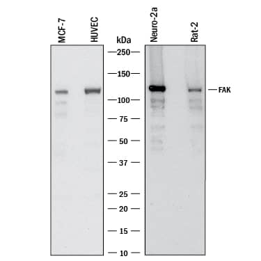 Western blot shows lysates of MCF‑7 human breast cancer cell line, HUVEC human umbilical vein endothelial cells, Neuro‑2A mouse neuroblastoma cell line, and Rat‑2 rat embryonic fibroblast cell line. PVDF membrane was probed with 1 µg/mL of Sheep Anti-Human/Mouse/Rat FAK Antigen Affinity-purified Polyclonal Antibody (Catalog # AF4467) followed by HRP-conjugated Anti-Sheep IgG Secondary Antibody (HAF016). A specific band was detected for FAK at approximately 125 kDa (as indicated). This experiment was conducted under reducing conditions and using Western Blot Buffer Group 1.