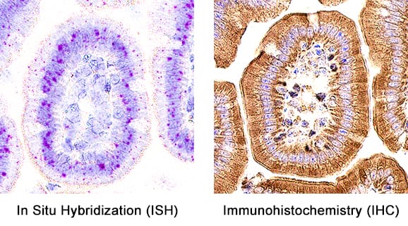 Formalin-fixed paraffin-embedded tissue sections of mouse intestine were probed for IL-15 mRNA (ACD RNAScope Probe, catalog # 440651; Fast Red chromogen, ACD catalog # 322360). Adjacent tissue section was processed for immunohistochemistry using goat anti-mouse IL-15 polyclonal antibody (R&D Systems catalog # AF447) at 1ug/mL with overnight incubation at 4 degrees Celsius followed by incubation with anti-goat IgG VisUCyte HRP Polymer Antibody (Catalog # VC004) and DAB chromogen (yellow-brown). Tissue was counterstained with hematoxylin (blue). Specific staining was localized to glandular cells.  