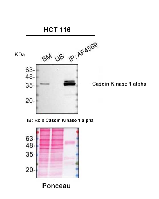 Immunoprecipitation Casein Kinase 1 alpha Antibody [Unconjugated]