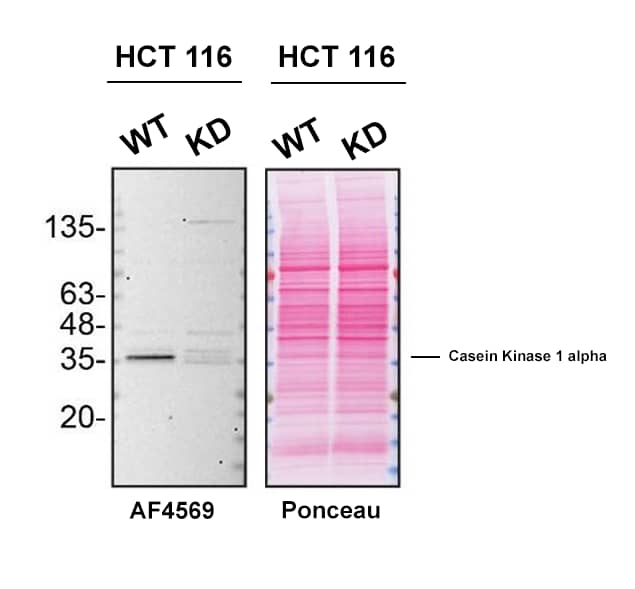 Knockdown Validated Casein Kinase 1 alpha Antibody [Unconjugated]